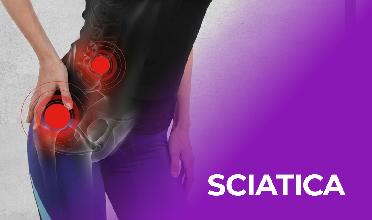 sciatica-pain-treatment